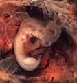 Embryo humanus quinque hebdomadarum