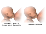 Breastfeeding - Incorrect vs correct latch-on.