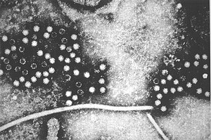E형 간염바이러스의 투과전자현미경 사진