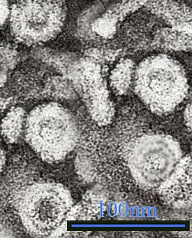 ПЭМ-микрофотография, показывающая вирионы вируса гепатита B