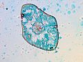 トウヒ属の葉の断面の顕微鏡写真