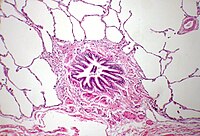 Coupe van het longweefsel. In het midden een bronchiole met daaromheen alveoli