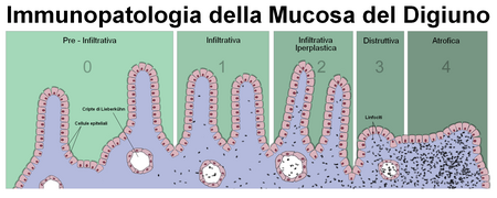 CoeliacDisease - ITA.png