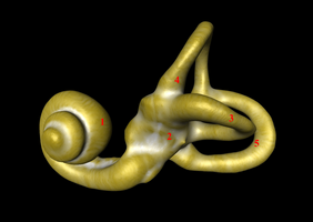 Labyrinthe osseux gauche / tomodensitométrie 3D[3]