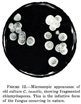 Coccidioides immitis