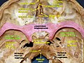 Greater wing of sphenoid bone