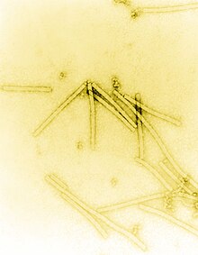 Electron micrograph of TMV particles negative stained to enhance visibility at 160,000× magnification