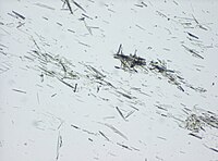 Light microscopy of a touch preparation of a gout tophus, showing needle-shaped crystals.