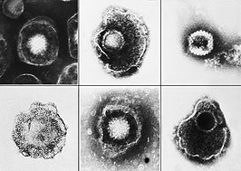 Herpesvirussen