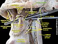 Facial artery