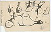 Injured Purkinje neurons of the cerebellum, 1914