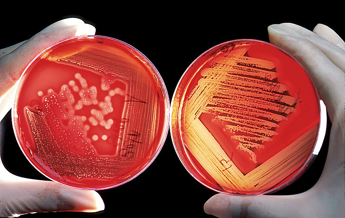 Dua buah lempeng agar darah untuk menumbuhkan bakteri Staphylococcus (kiri) dan Streptococcus (kanan)