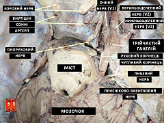 Trigeminal ganglion uk.jpg