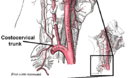 Costocervical trunk