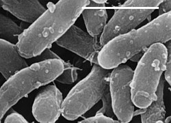 Bakterio - Gemmatimonas aurantiaca (- = 1 mikrometro)