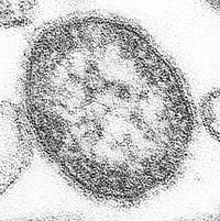 Mæslingevirus 100-200 nm i diameter