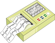 Equipment_-_ECG_monitor_--_Smart-Servier