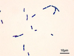 Bacillus cereus zabarwione na kolor ciemnofioletowy, Gram-dodatnie