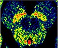 Enhanced Neuromelanin MRI with Color images (RGB) showing Substantia nigra pars compacta