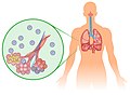 ウイルスが肺胞に感染