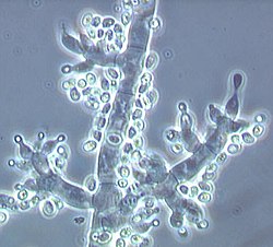 Conidioforen van Trichoderma fertile met vaasvormige phialiden en nieuw gevormde conidiën aan de toppen (lichte puntjes).