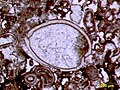 Image 16Articulated ostracod valves in cross-section from the Permian of central Texas; typical thin section view of an ostracod fossil (from Ostracod)