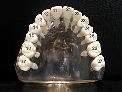 Notation ISO pour les dents de la mâchoire supérieure