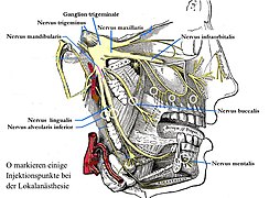 Lokalanaesthesie-Injektionspunkte.jpg