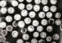 Isifo sohudoI-electron micrograph ye-rotavirus, yimbangela ecishe ibe-40% yokulaliswa esibhedlela ngenxa yesifo sohudo ebantwaneni abangaphansi kweminyaka yobudala emihlanu.[1]