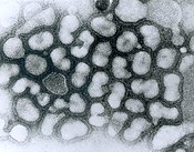 Influenza A virus i elektronmikroskop