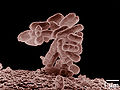 Escherichia coli (γ)