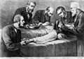 Operation on the throat of the Kaiser Frederick III by drs. Morell Mackenzie, Hermann Krause (1848–1921), Friedrich Gustav von Bramann and others