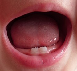 ثنايا سفلية لبنية عند رضيع عمره 7 أشهر. لاحظ الحواف القاطعة التي تعطي الأسنان مظهرًا مسننًا.