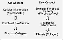 Etiology and pathobiology of Idiopathic Pulmonary Fibrosis