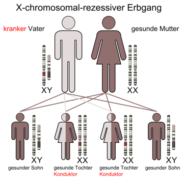 X-chromosomal durch den Vater vererbtes Merkmal. Alle Töchter besitzen ein rezessives Allel, ohne selbst betroffen zu sein – d. h. sie sind gesund, können aber diese Anlage weitergeben (siehe X-chromosomal durch die Mutter vererbtes, rezessives Merkmal).