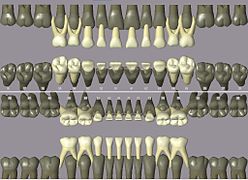 Notation ISO pour les dents temporaires