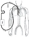 Veno-arterijski modalitet (VAECMO)