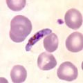 Sichelförmiger Gametozyt von P. falciparum im Blutausstrich.