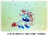 抗酸菌染色の像。らい菌は赤色に染色されている