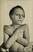 The health-care of the growing child; (1919) (14594660478).jpg