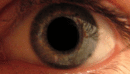 Dilatation de la pupille.