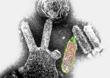 CSIRO ScienceImage 1977 Bat Lyssavirus.jpg