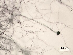 Micrografia de A. niger com ampliação 100x.