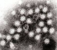 Norovirus particulas in feces (transmission electron micrographia).