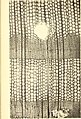 Image 28A thin transverse section showing the internal structure of conifer wood (from Conifer)