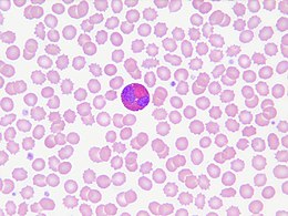 Description de l'image Eosinophils in peripheral blood.jpg.