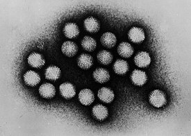 Микрофотографияи аденовирусҳо дар МЭУ