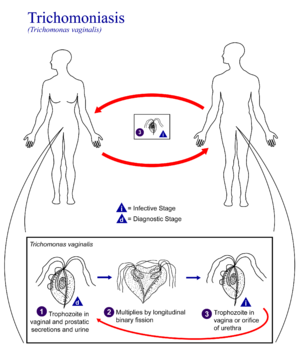 Епідеміологічний ланцюг зараження на трихомоноз