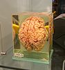 Cerveau humain conservé dans du formol.