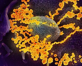 ויריוני SARS-CoV-2 (בצהוב) מגיחים מתא אנושי (בתרביות תאים במעבדה)